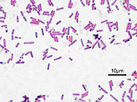Bacillus subtilis Gram.jpg