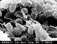 Imagen de microscopio electrónico mostrando una masa de bacterias Yersinia pestis (causa de las plagas bubónicas)