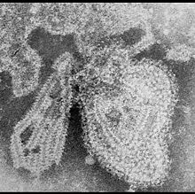 Mumps virus.jpg