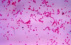 Fusobacterium novum 01.jpg