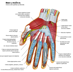 Wrist and hand deeper palmar dissection-es.svg