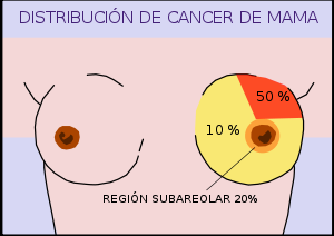 Distribución cancer de mama.svg
